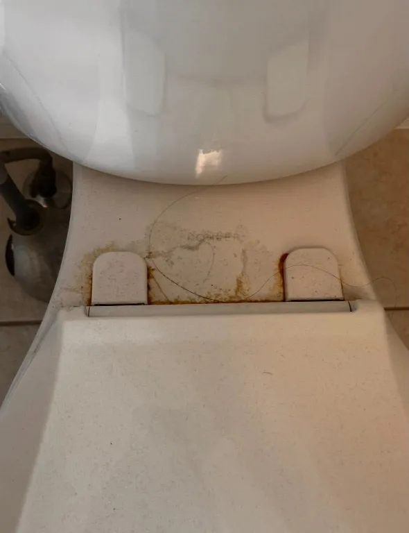 Toilet seat & hinges — before